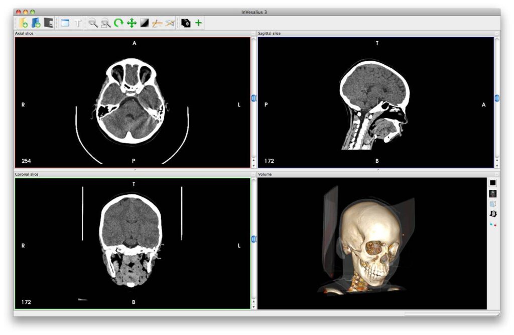 DICOM viewer android