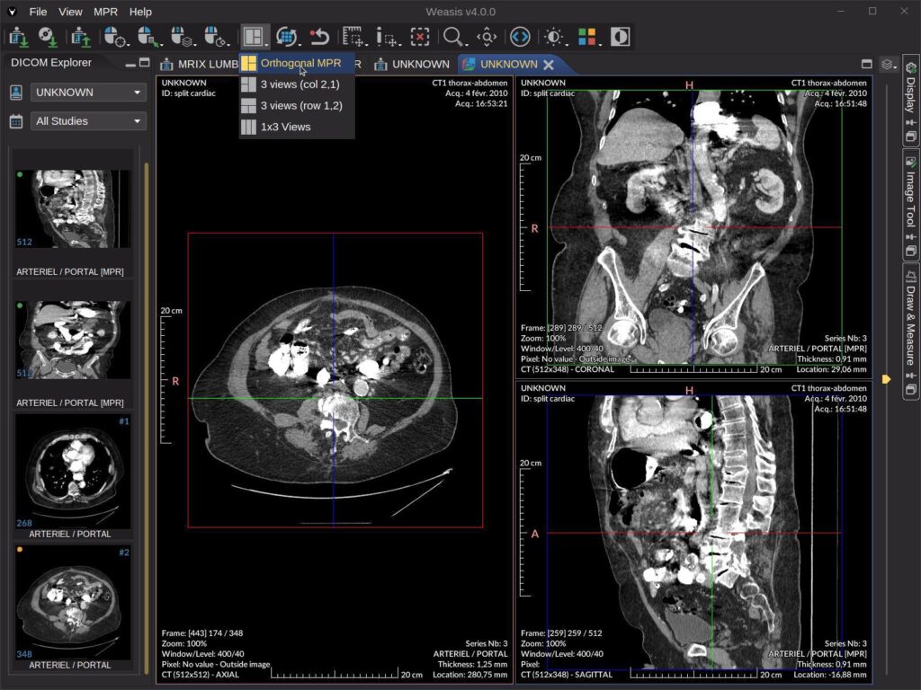 Can You Integrate DICOM Viewers Easily? DICOM viewer library